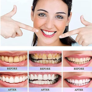Oralhoe - Nicotinamide Dazzle White Toothpaste